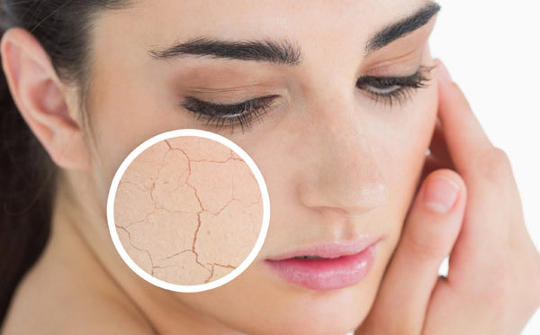 Memiliki Kulit Wajah Yang Kusam? Tak Perlu Khawatir, Ini Dia Cara Praktis Menghilangkannya